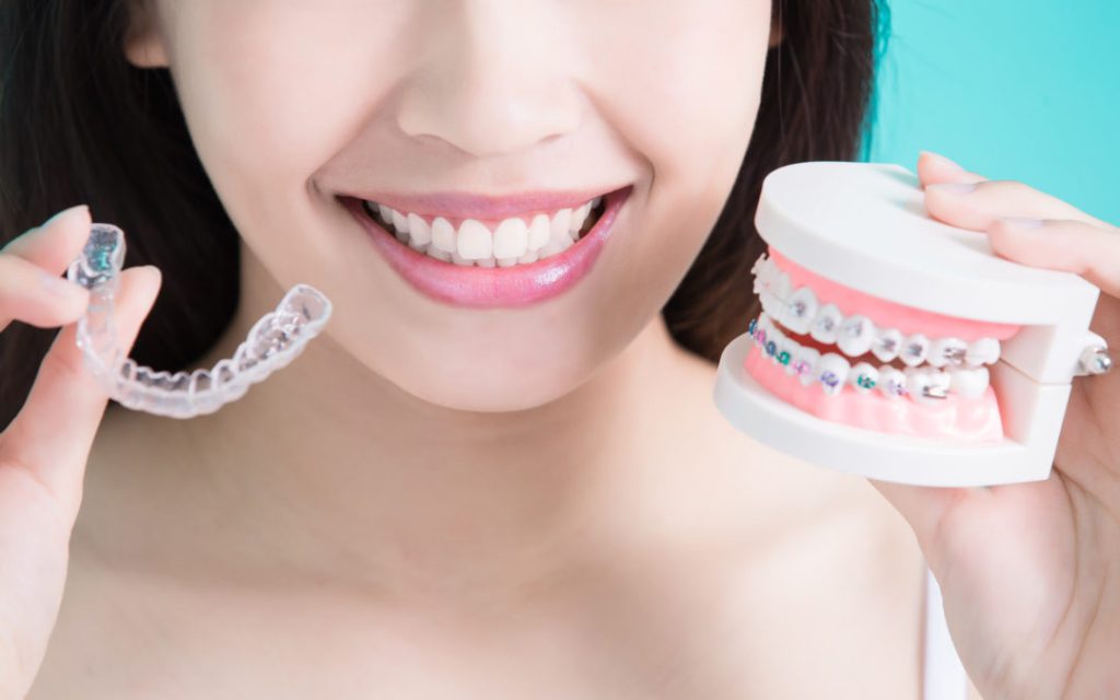 Invisalign Price Compared to Braces